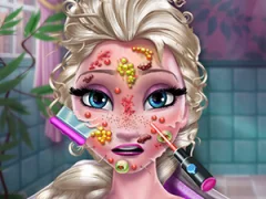 Hra Ice Queen Skin Doctor online