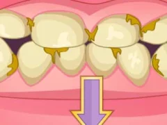 Hra Bad Teeth Makeover online