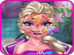 Hra Ice Queen Doctor online