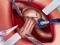 Hra Princess Hips Surgery online