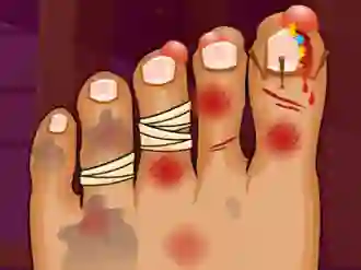 Hra Monster Foot Doctor online
