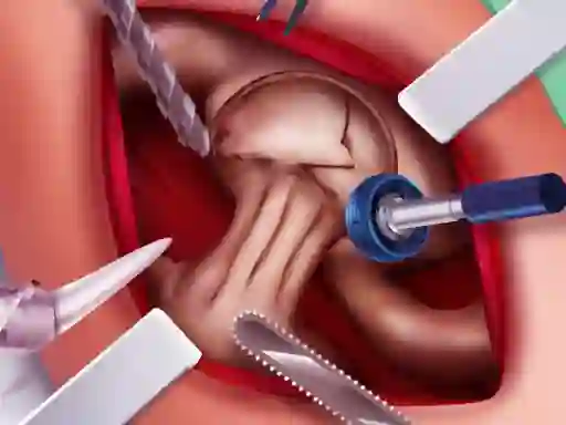 Hra Princess Hips Surgery online