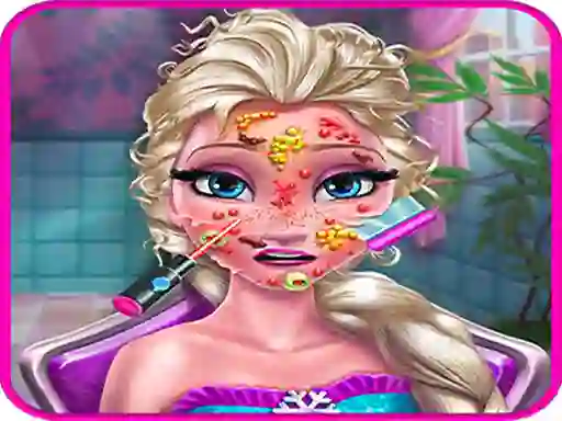 Hra Ice Queen Doctor online